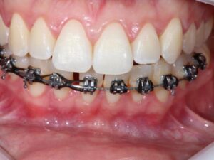dentistica