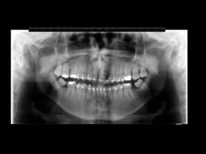 endodontia