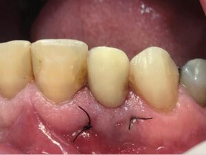periodontia